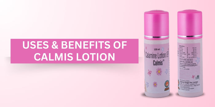 Soothe the Itch Fast: Uses and Benefits of calamine lotion for skin ...