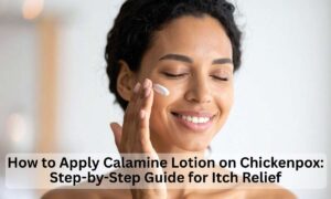 apply calamine lotion