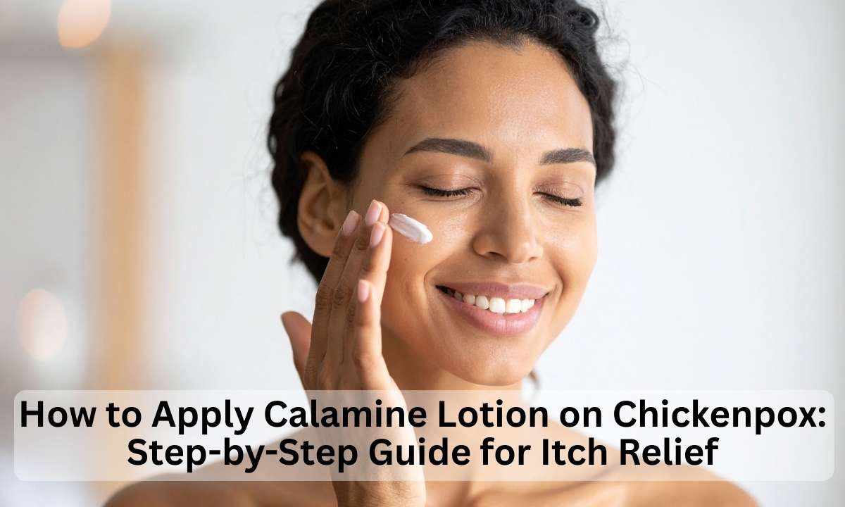 apply calamine lotion
